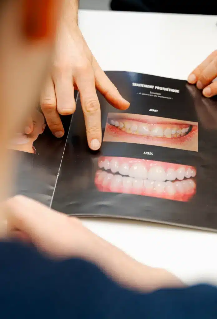 Remplacer une ou plusieurs dents : préserver l’équilibre du sourire