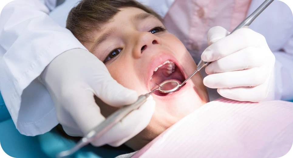 Scellement des sillons pour prévenir les caries