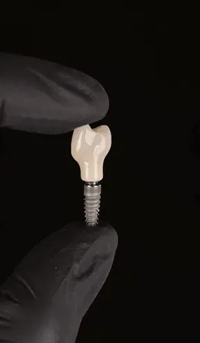 Implant dentaire