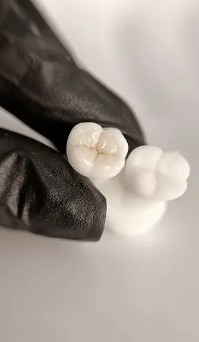 Restauration des dents